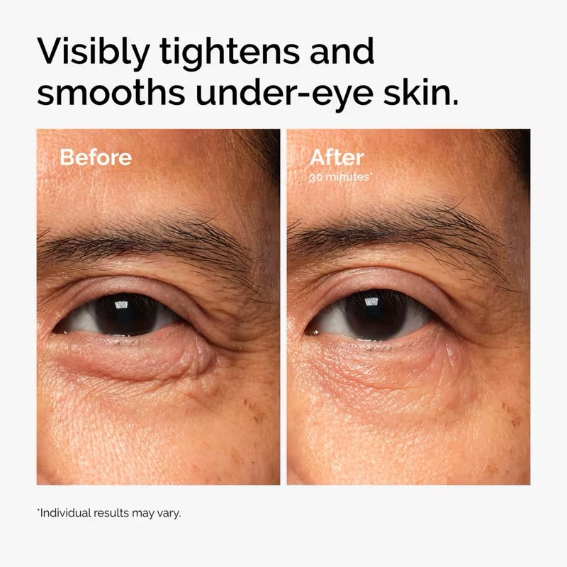 The Ordinary - Lacto-PDRN* 4% + B9 Eye Cream