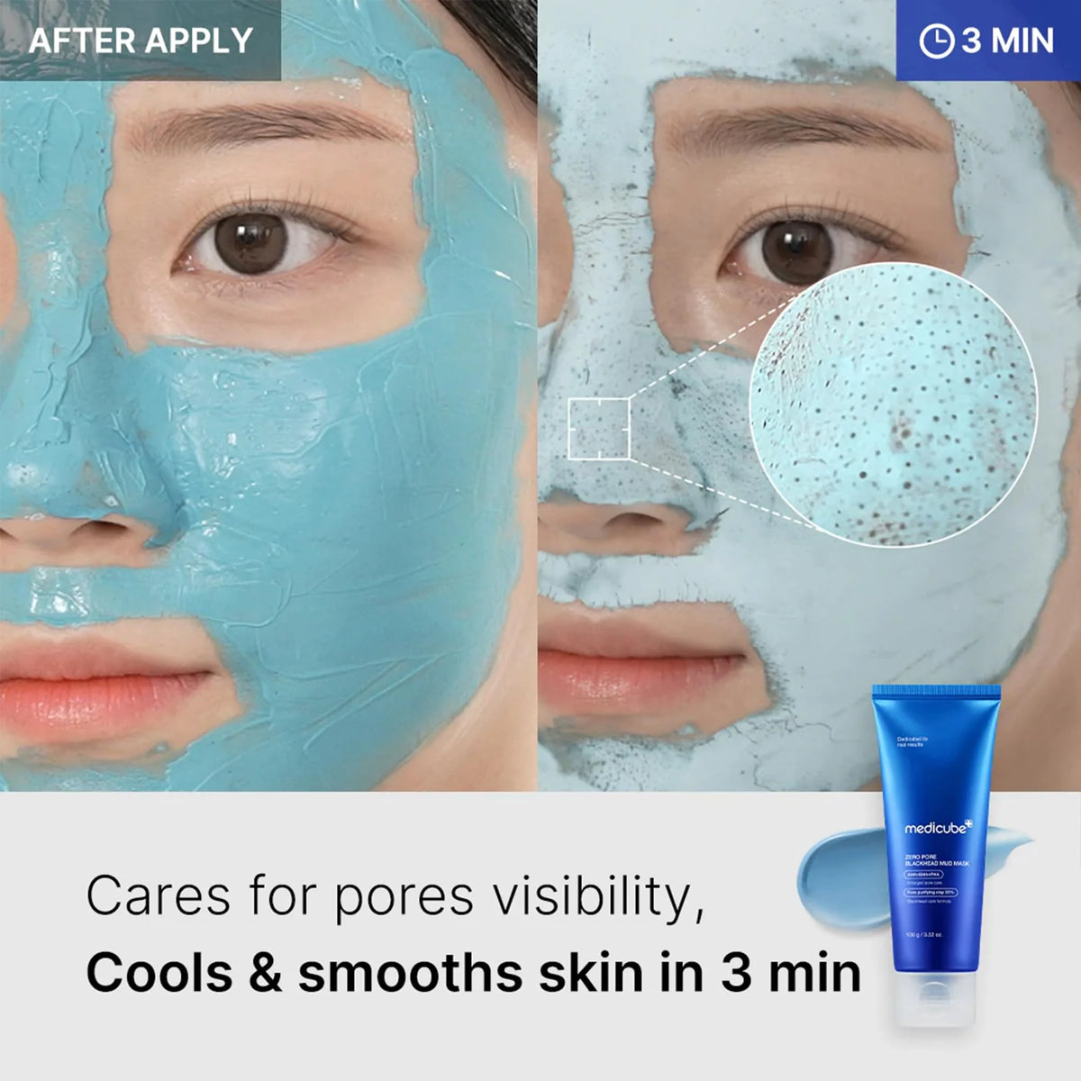 Medicube - Zero Pore Blackhead Mud Mask