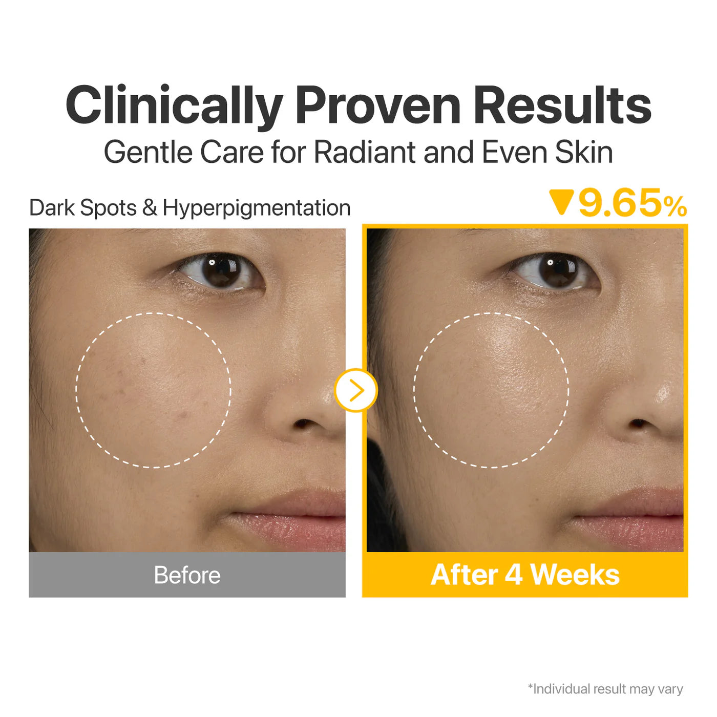 Numbuzin No. 5+ Glutathione Vitamin Concentrated Serum