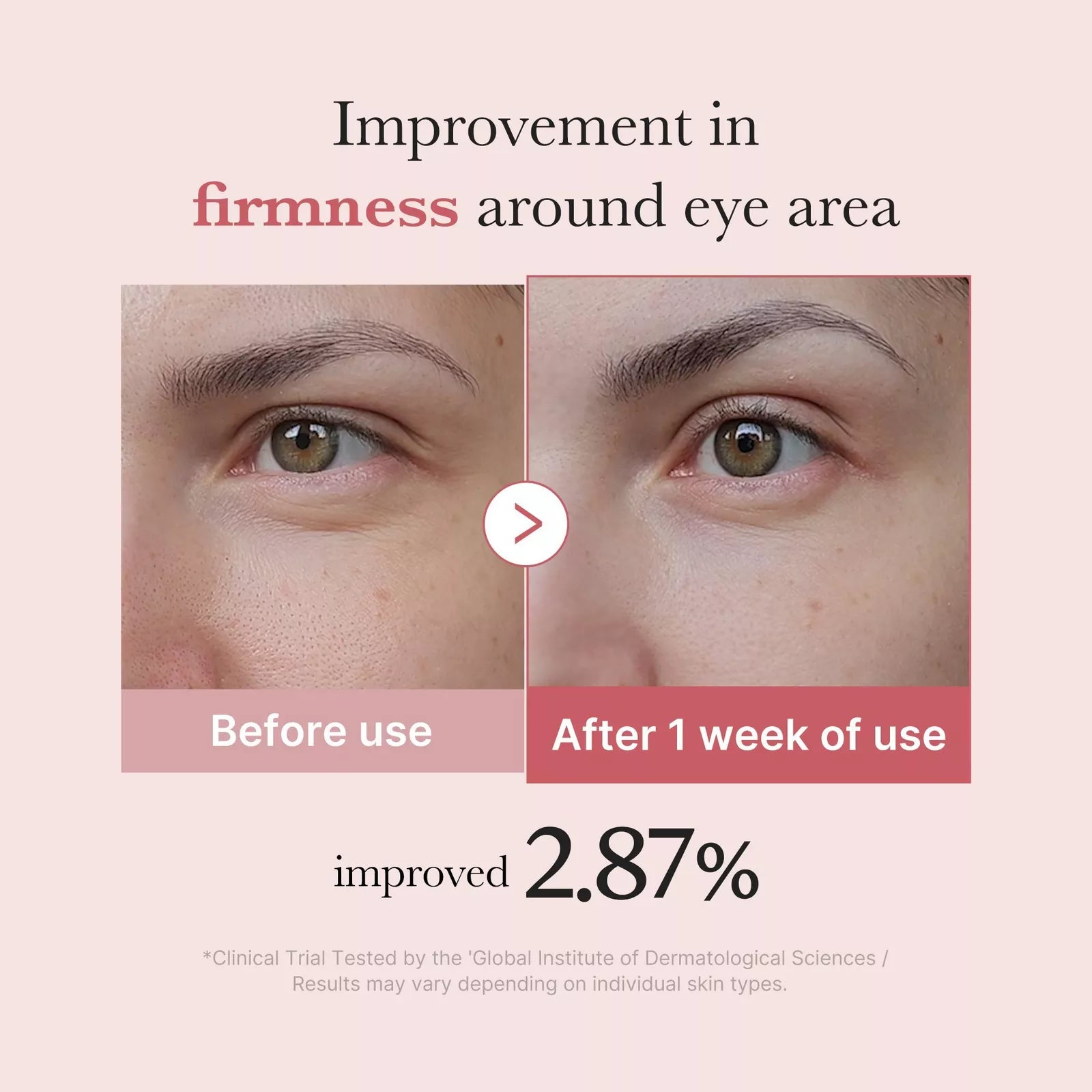 Medicube PDRN Pink Peptide Eye Cream