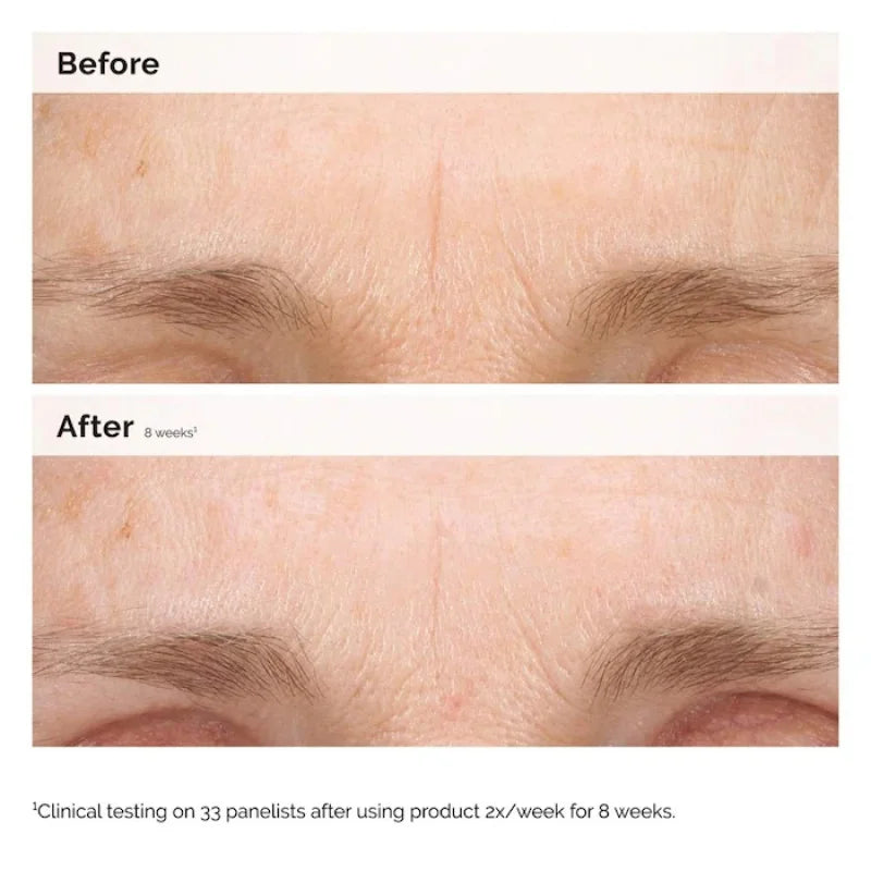 The Ordinary Retinal 0.2% Emulsion