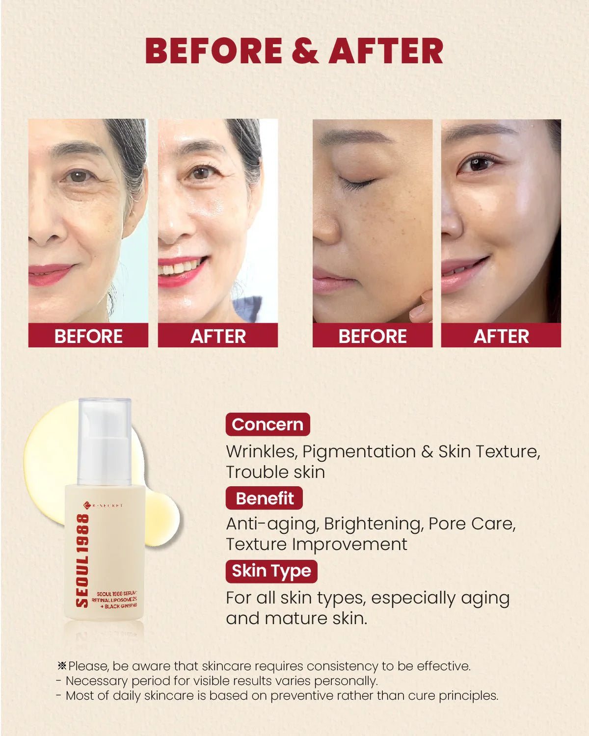KSECRET  Seoul 1988 Serum: Retinal Liposome 2% + Black Ginseng