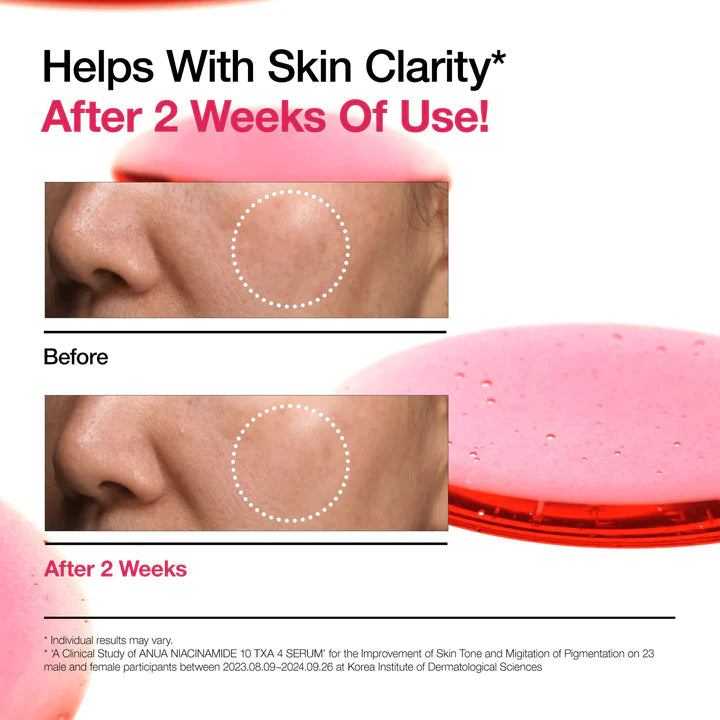 Anua Niacinamide 10% + Txa 4% Serum